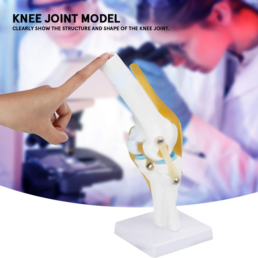 Anatomical Medical Knee Joint with Ligaments Model, Life Size Human Knee Joint Model Knee Joint Model for Skeleton Anatomy Study Teach with Ligament Model, for Display Teaching - Just Closeouts Canada Inc.X004GZTZK7